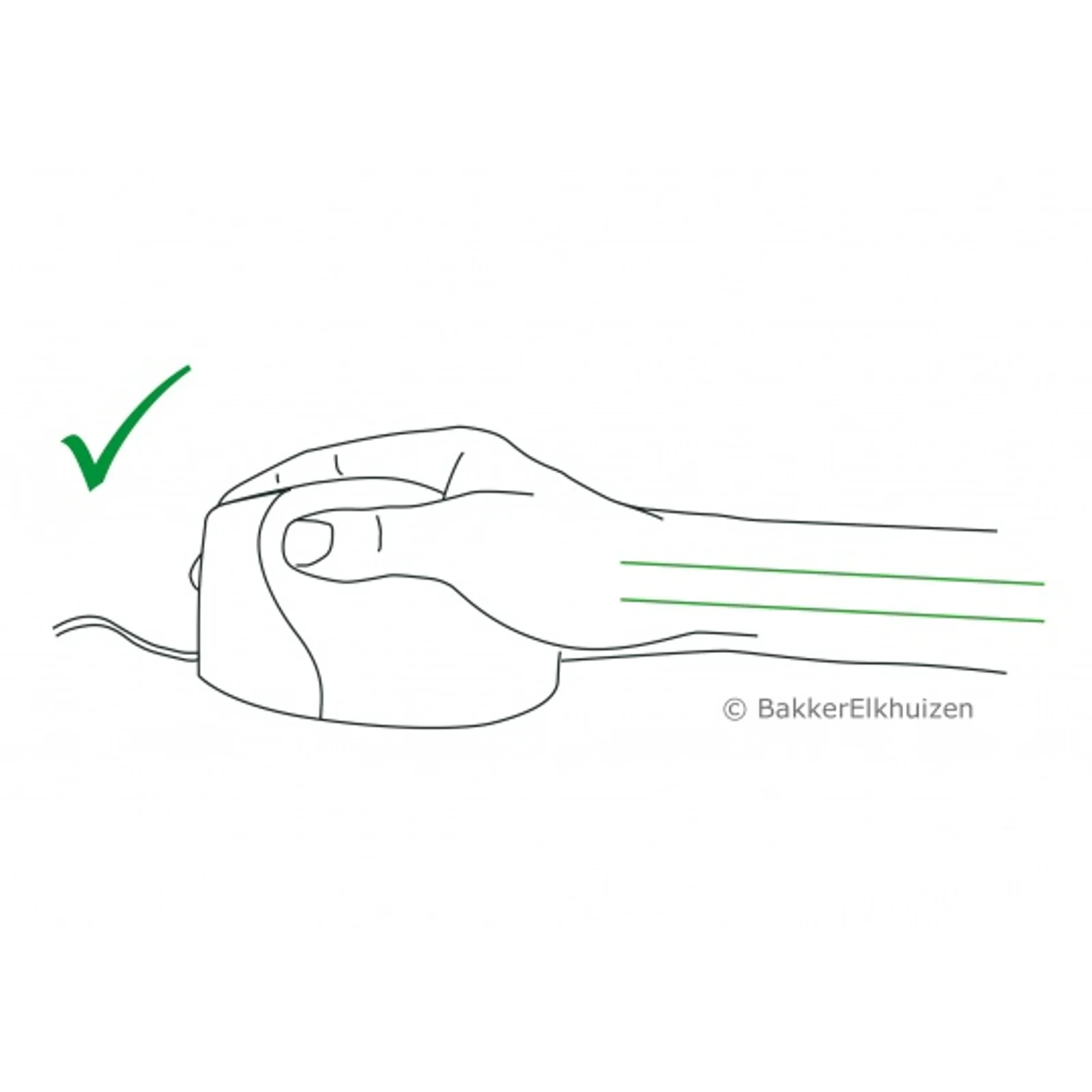 BakkerElkhuizen Evoluent 4 Small Wireless